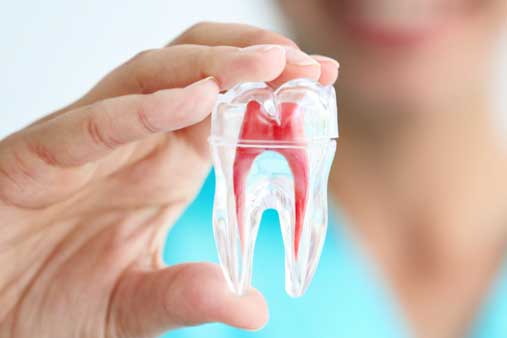 Getting to the Root of Root Canals